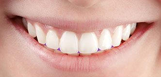 Zahnform und Zahnbogen